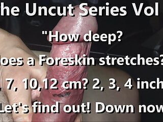 The Uncut Series Vol 7: How Deep Can Foreskin Be Stretched?