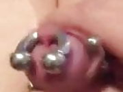 Abspritzen