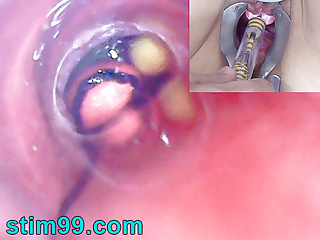 Urethra Insertion, Endoscope, Brutal Sex, Stim 99