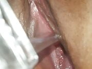Gaping cunt with speculum cervic expose big hole