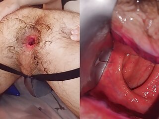 Hairy and gaped wide – inside view though speculum and noisy hole gape