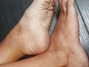 My feet1