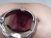 Elmer's Wife Anal fisting speculum 2