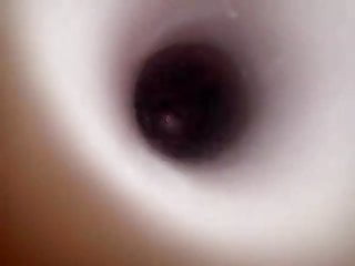 Inside the anus 2 